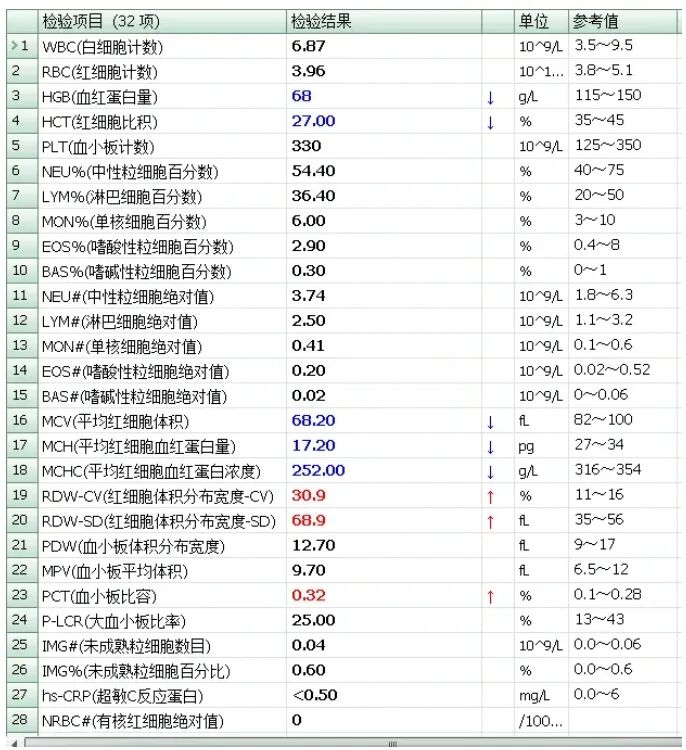 rbc直方图怎么看【安医科普】红细胞直方图解析_https://www.jmylbn.com_新闻资讯_第10张