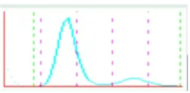 rbc直方图怎么看【安医科普】红细胞直方图解析_https://www.jmylbn.com_新闻资讯_第11张