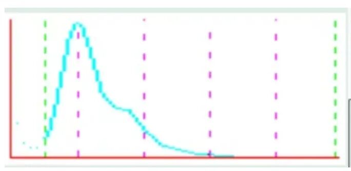 rbc直方图怎么看【安医科普】红细胞直方图解析_https://www.jmylbn.com_新闻资讯_第7张