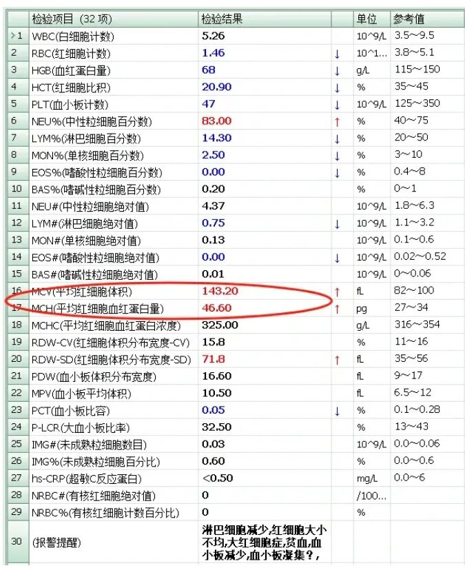 rbc直方图怎么看【安医科普】红细胞直方图解析_https://www.jmylbn.com_新闻资讯_第6张