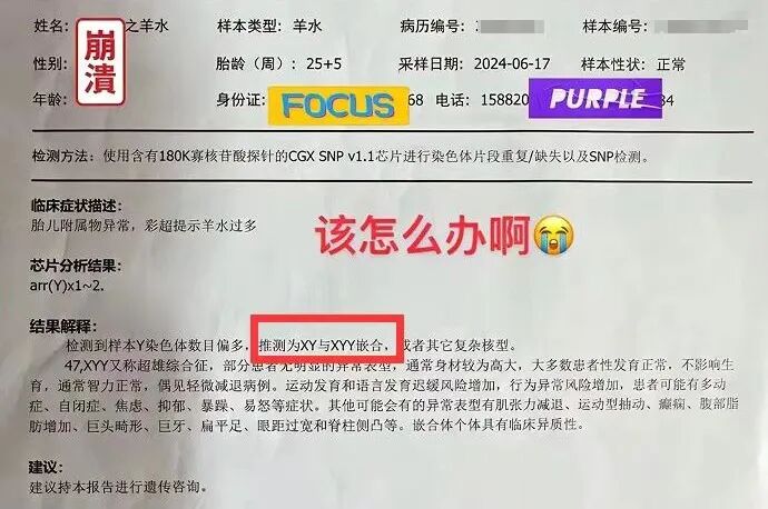 md是胎儿的什么胎儿查出47,XYY，全网劝退，“超雄综合征”，你了解吗？-上海聚慕医疗器械有限公司