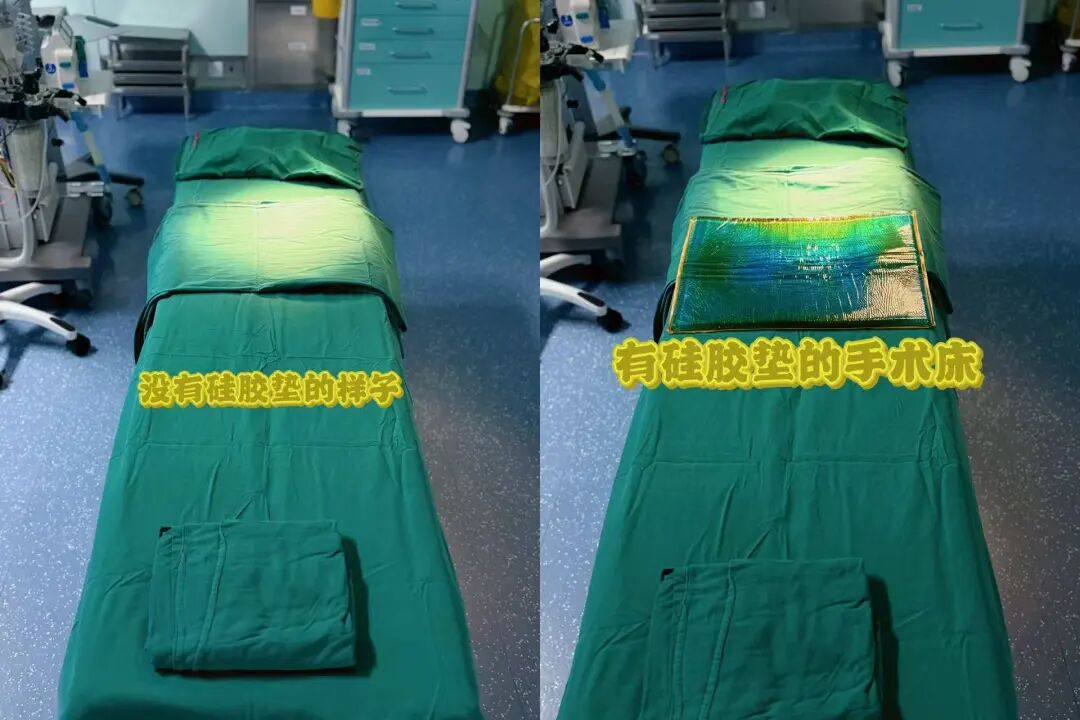 手术室体位垫怎么用手术室里的＂隐形守护者＂——硅胶体位垫的奇妙物语_https://www.jmylbn.com_新闻资讯_第8张