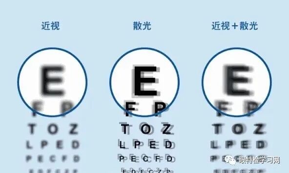 怎么测角膜直径【散光测量误差】——白内障术后残余散光形成原因_https://www.jmylbn.com_新闻资讯_第1张
