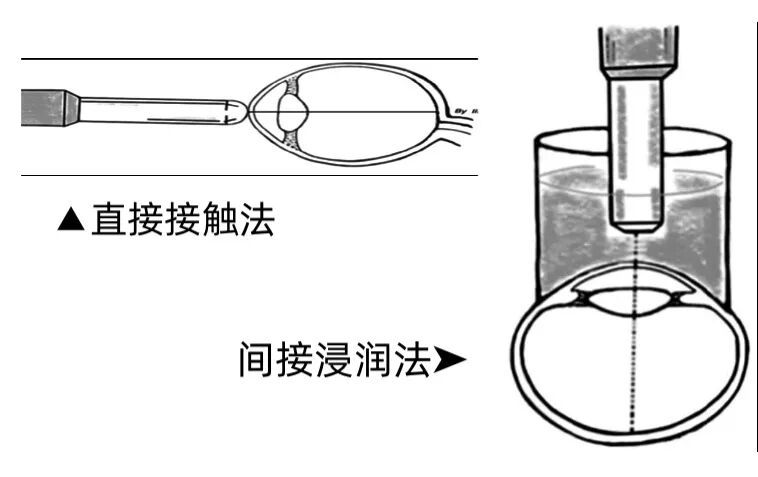 眼科ab超怎么操作了解眼科检查——A型超声_https://www.jmylbn.com_新闻资讯_第7张