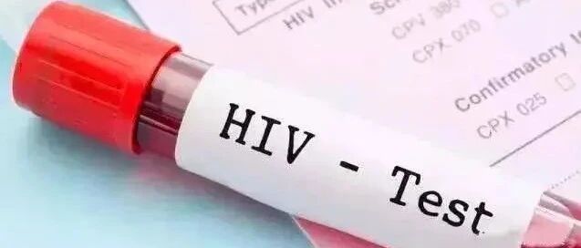 带你认识艾滋病的核酸检测！