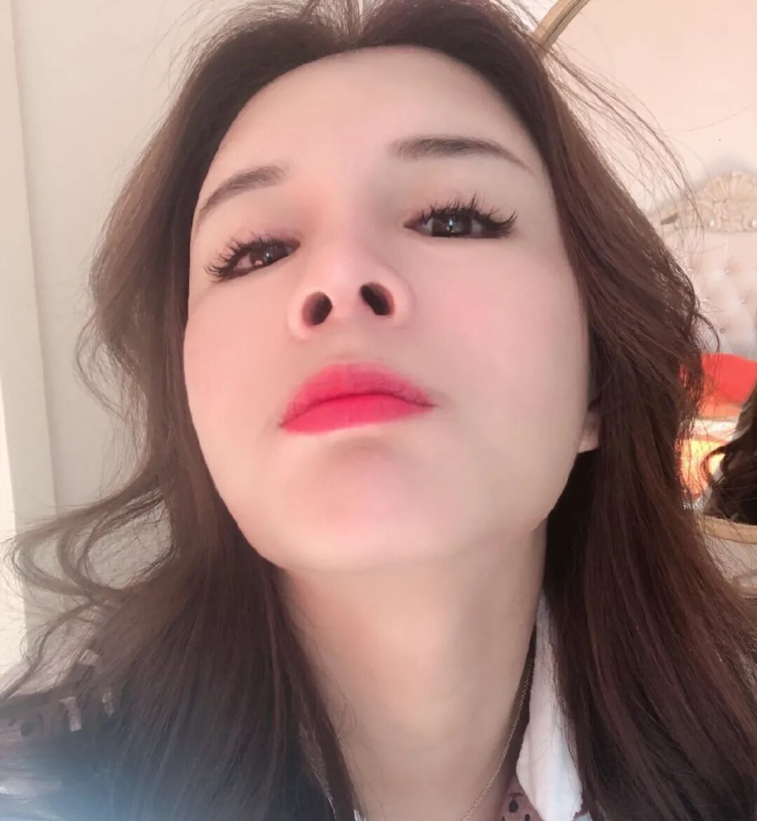 可吸收缝线怎么拆为什么明明有可吸收线，术后却还要回院拆线？_https://www.jmylbn.com_新闻资讯_第8张