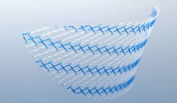 可溶止血纱布怎么吸収产业用 ｜ 无影灯下显身手！外科医用纺织品功能超出你想象_https://www.jmylbn.com_新闻资讯_第4张