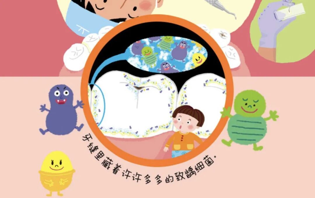 龃齿介绍了龋齿是怎么形成的.