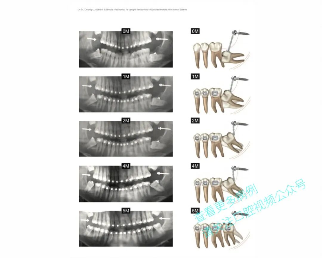 一位顶尖牙医的处理，思路是亮点