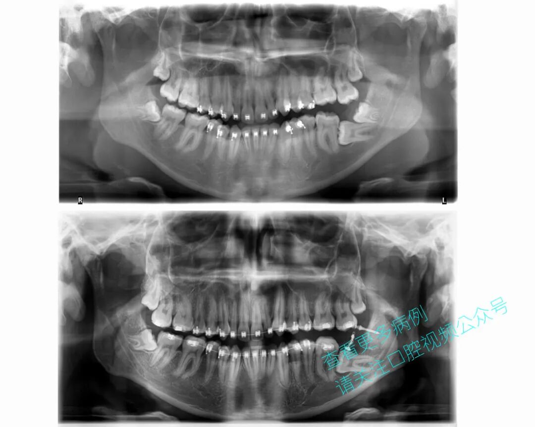 一位顶尖牙医的处理，思路是亮点