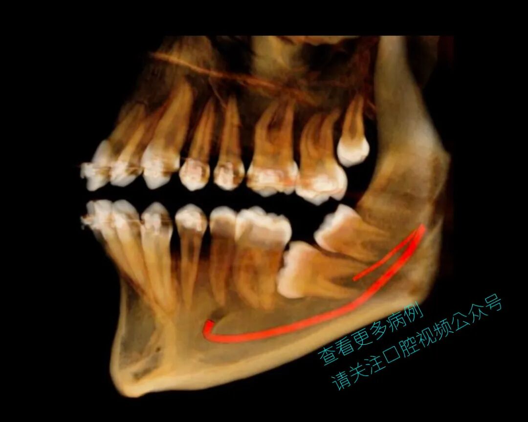 一位顶尖牙医的处理，思路是亮点