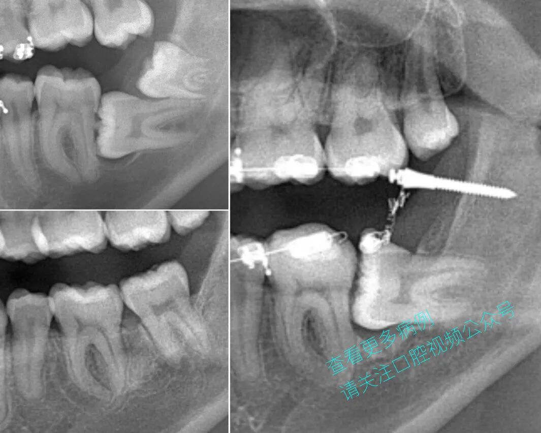 一位顶尖牙医的处理，思路是亮点