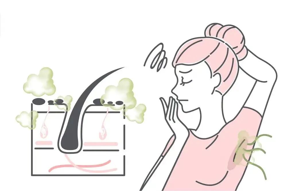 【福州福兴康复医院腋臭专科】福州治腋臭哪最好？发育期的女孩腋下有汗臭味，什么原因导致的？