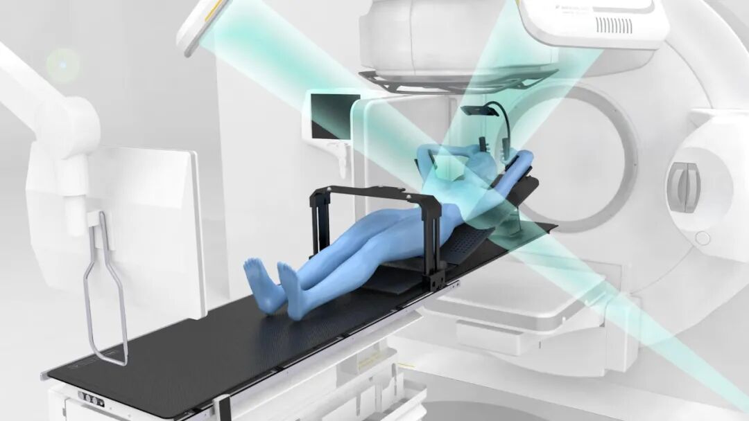 微动态深吸气屏气dibh技术让乳腺癌患者不伤心更安心