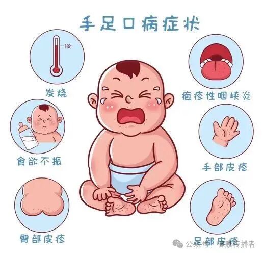 手足口病特效调理方