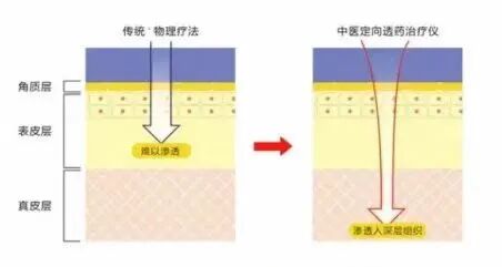 中医定向透药治疗什么中医定向透药治疗——让您一通到底、一身轻松_https://www.jmylbn.com_新闻资讯_第1张