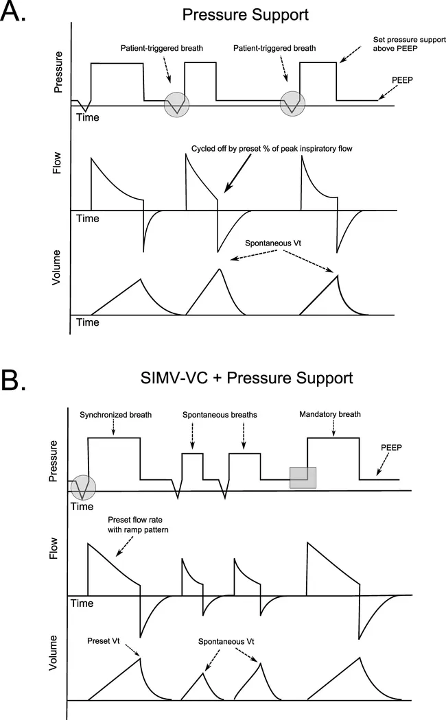 呼吸机ac是什么意思机械通气基础_新闻资讯_第10张_活检穿刺产品网 呼吸机ac是什么意思机械通气基础_https://www.jmylbn.com_新闻资讯_第10张