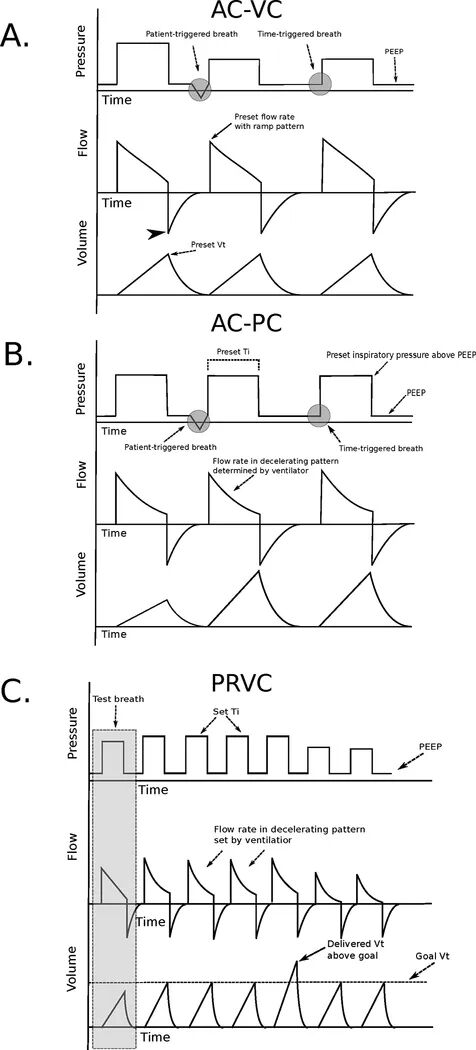 呼吸机ac是什么意思机械通气基础_https://www.jmylbn.com_新闻资讯_第7张