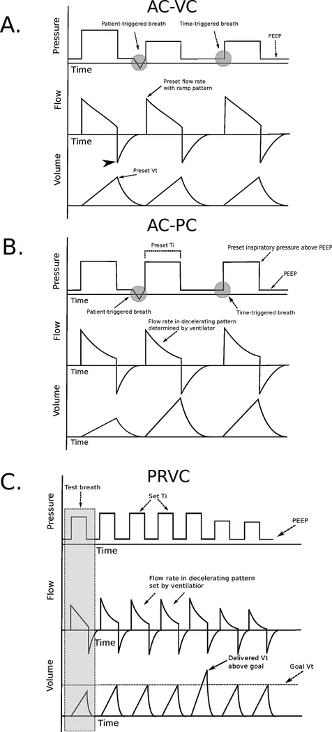 呼吸机ac是什么意思机械通气基础_新闻资讯_第7张_活检穿刺产品网 呼吸机ac是什么意思机械通气基础_https://www.jmylbn.com_新闻资讯_第7张