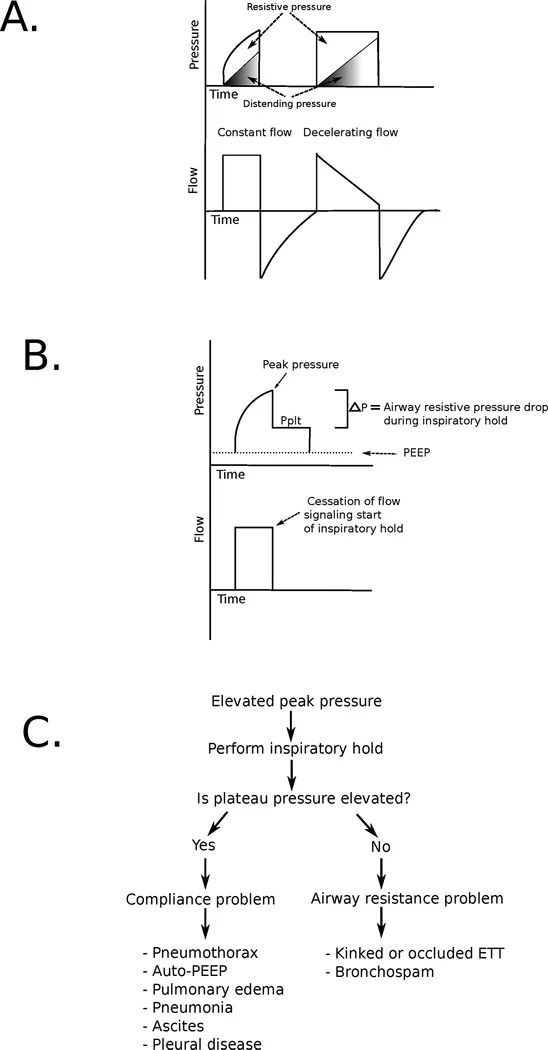 呼吸机ac是什么意思机械通气基础_https://www.jmylbn.com_新闻资讯_第21张