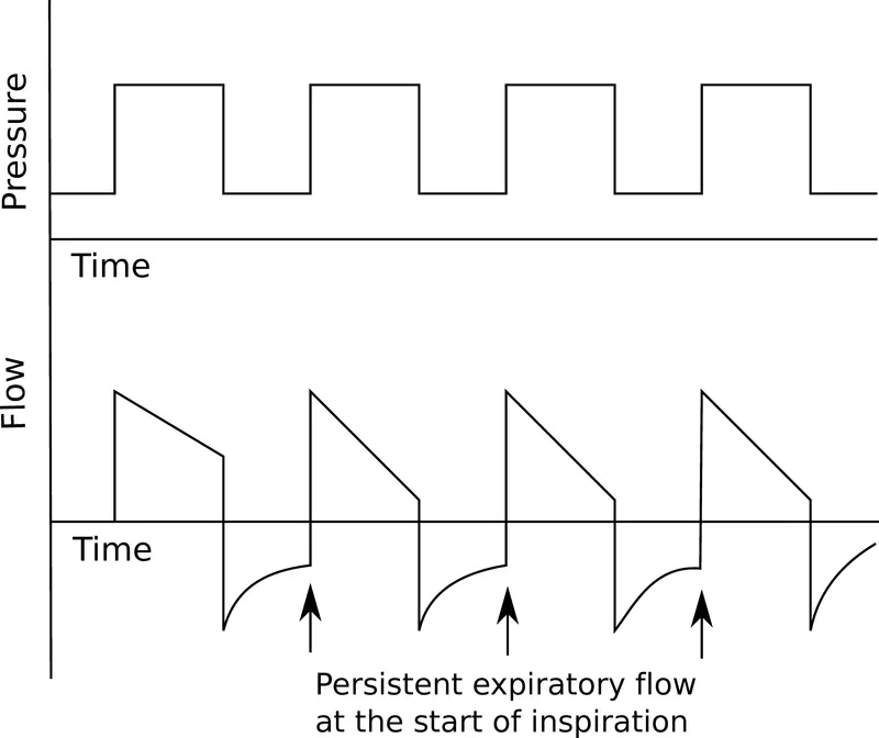 呼吸机ac是什么意思机械通气基础_新闻资讯_第26张_活检穿刺产品网 呼吸机ac是什么意思机械通气基础_https://www.jmylbn.com_新闻资讯_第26张