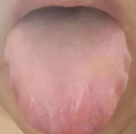 21天減肥法_ktv調聲_小孩能吃蒲地藍嗎