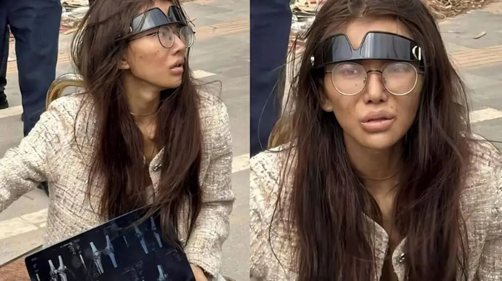 Umi, above, was found near a Cambodian hotel, looking gaunt and dirty, holding a CAT scan and suffering from a leg injury. Photo: RedNote