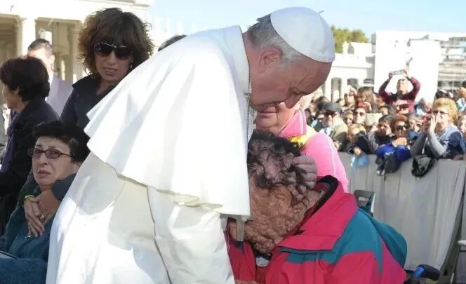 Man with disfigured face whose embrace with Pope Francis touched the world  dies | Catholic News Agency