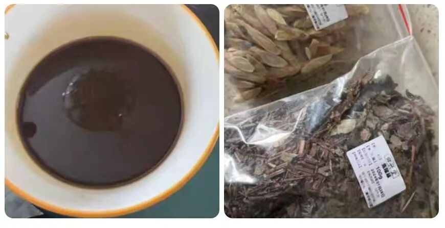 熬药袋怎么用选袋装中药还是自熬中药？_https://www.jmylbn.com_新闻资讯_第4张