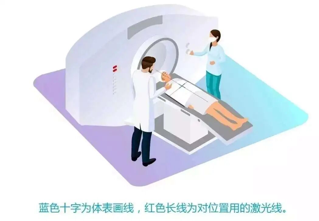 放疗怎么定位什么是放疗定位？_https://www.jmylbn.com_新闻资讯_第5张