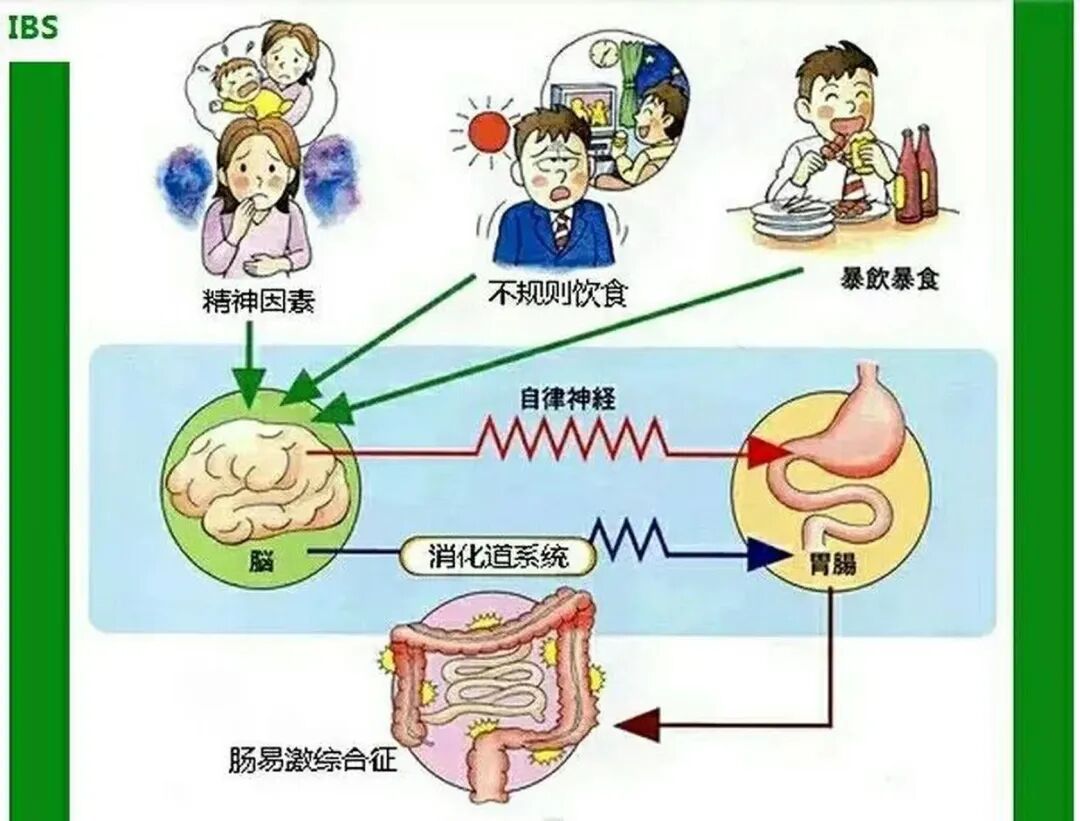 防治肠易激综合征中医有妙招