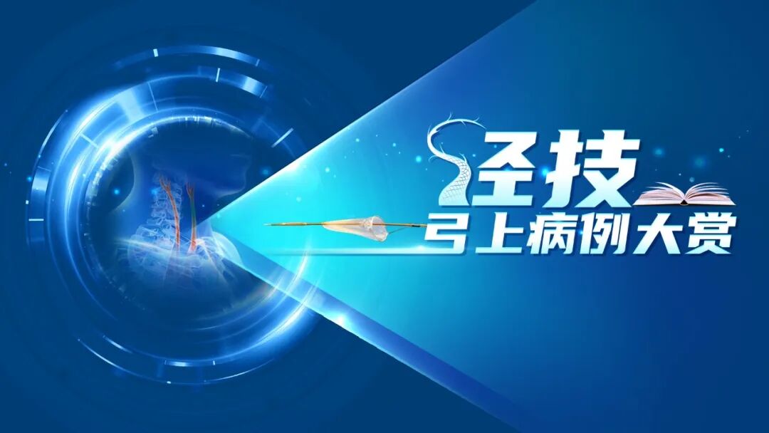 波科支架怎么样径技-弓上病例大赏｜第205期·放疗后症状性颈动脉狭窄支架置入治疗一例_https://www.jmylbn.com_新闻资讯_第1张
