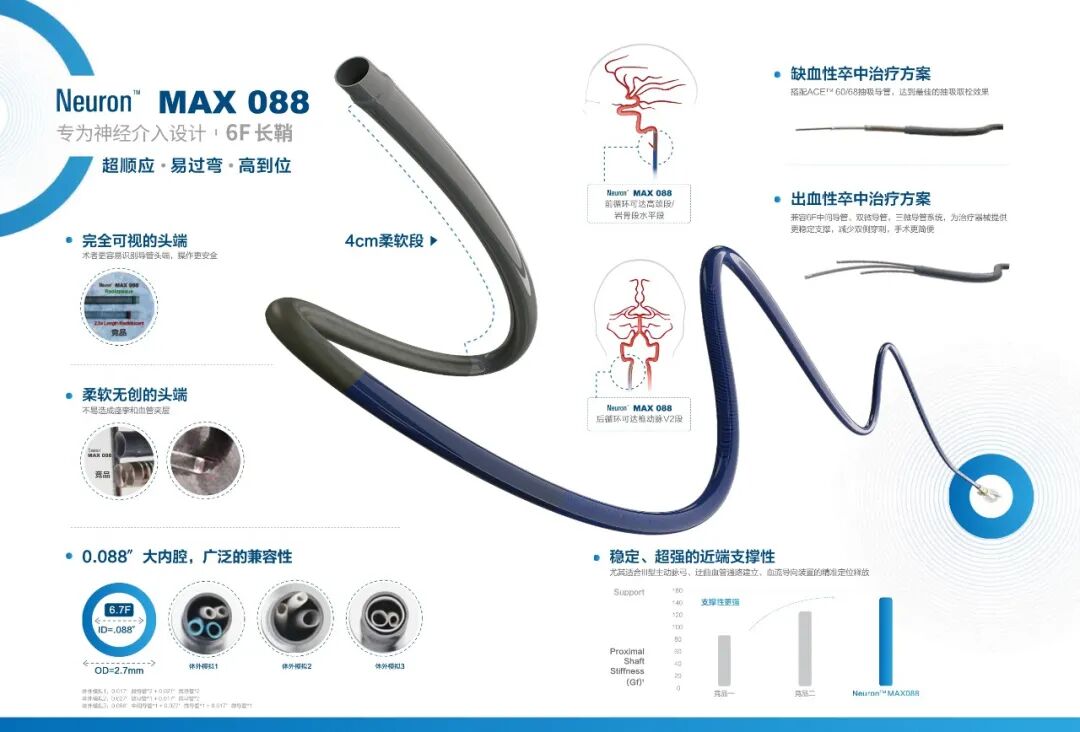 动脉长鞘怎么置入健谈卒中｜张志勇教授：伐竹取道，另辟蹊径  一例桡动脉入路经NeuronMax长鞘行左侧锁骨下动脉支架置入治疗_https://www.jmylbn.com_新闻资讯_第17张