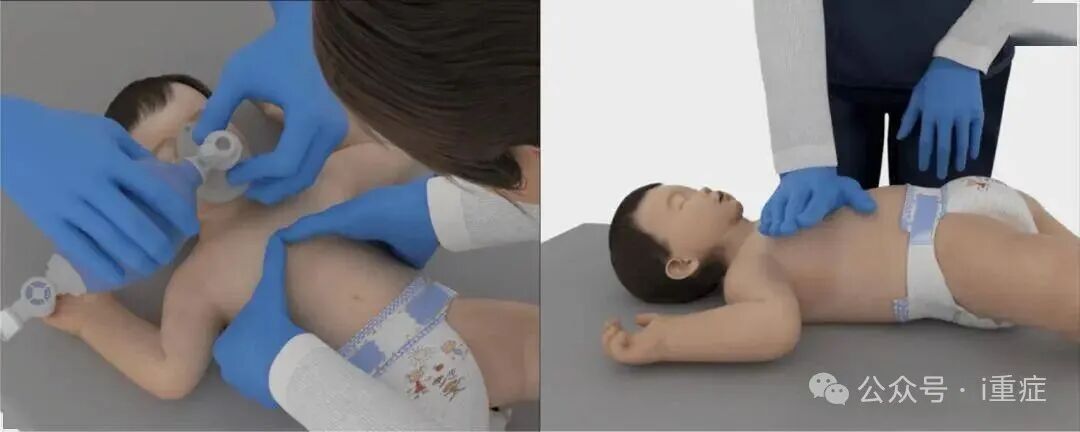 新生儿电极片怎么贴2025年美国AHA心肺复苏指南更新_https://www.jmylbn.com_新闻资讯_第23张