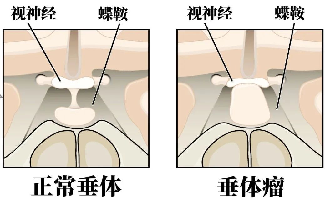 神经垂体光镜图图片