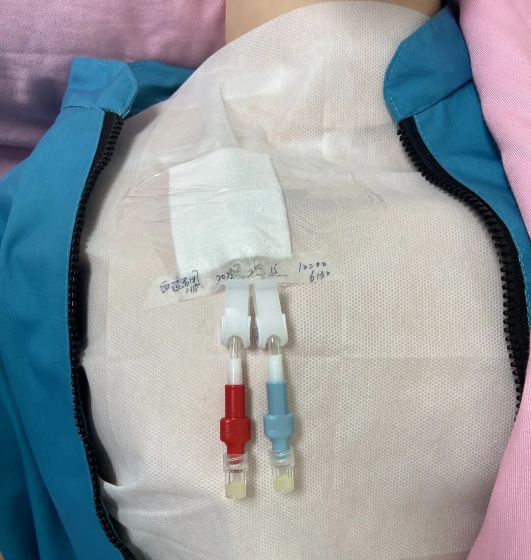 无菌纱块怎么使用一文让你学会透析导管自我换药_https://www.jmylbn.com_新闻资讯_第38张