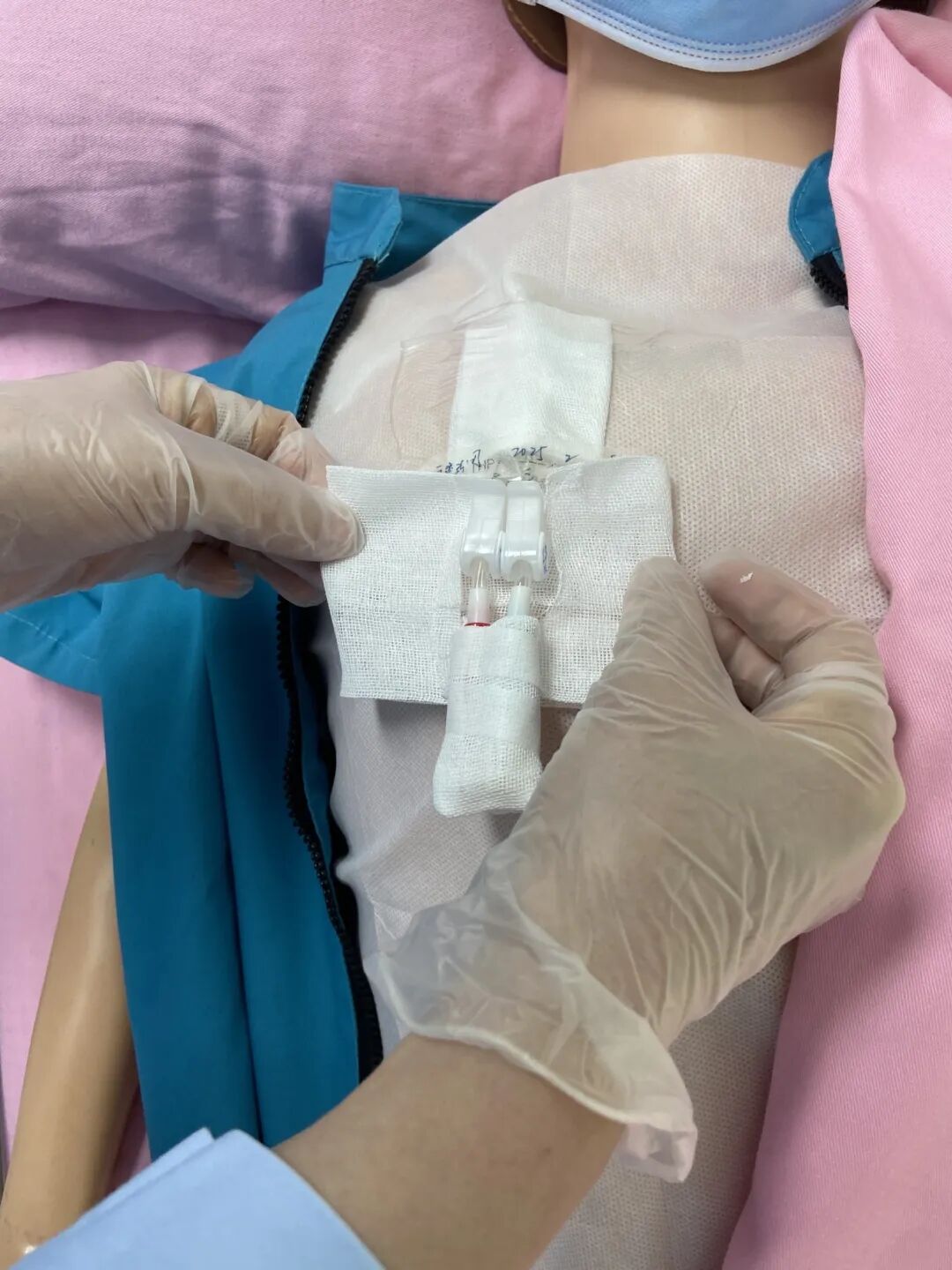 无菌纱块怎么使用一文让你学会透析导管自我换药_https://www.jmylbn.com_新闻资讯_第102张