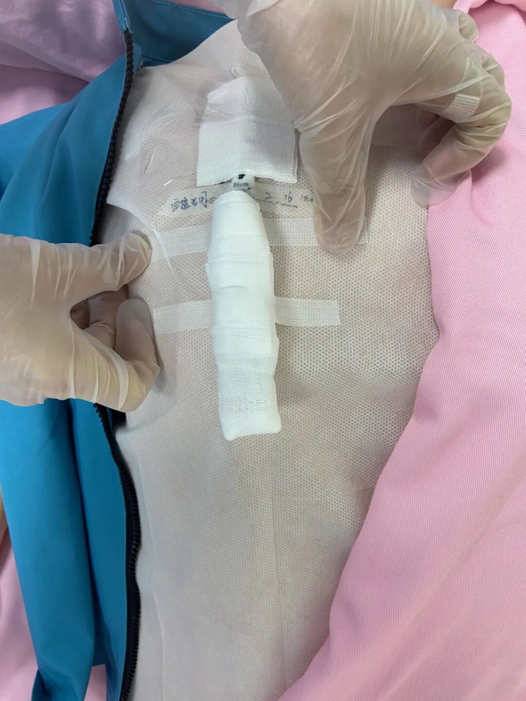 无菌纱块怎么使用一文让你学会透析导管自我换药_https://www.jmylbn.com_新闻资讯_第107张