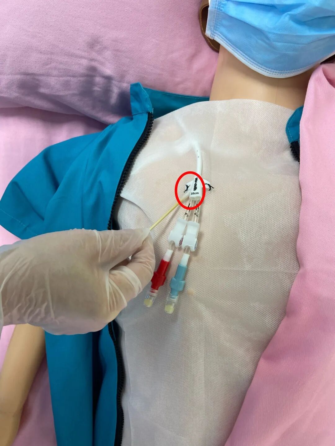 无菌纱块怎么使用一文让你学会透析导管自我换药_https://www.jmylbn.com_新闻资讯_第77张