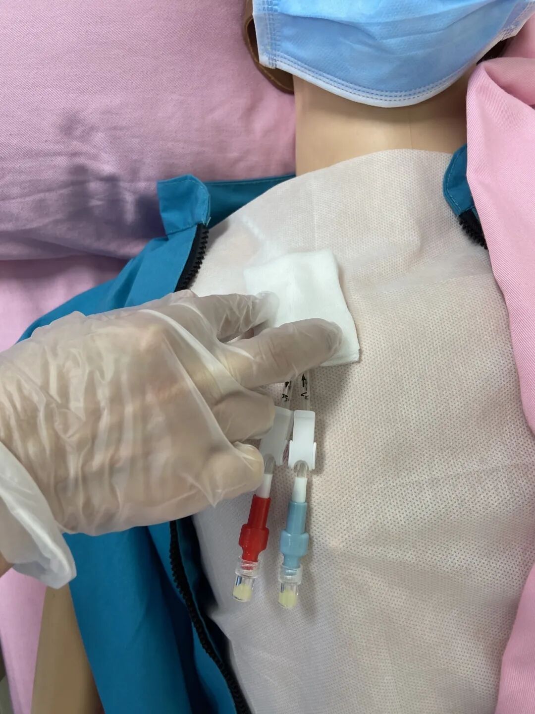 无菌纱块怎么使用一文让你学会透析导管自我换药_https://www.jmylbn.com_新闻资讯_第49张