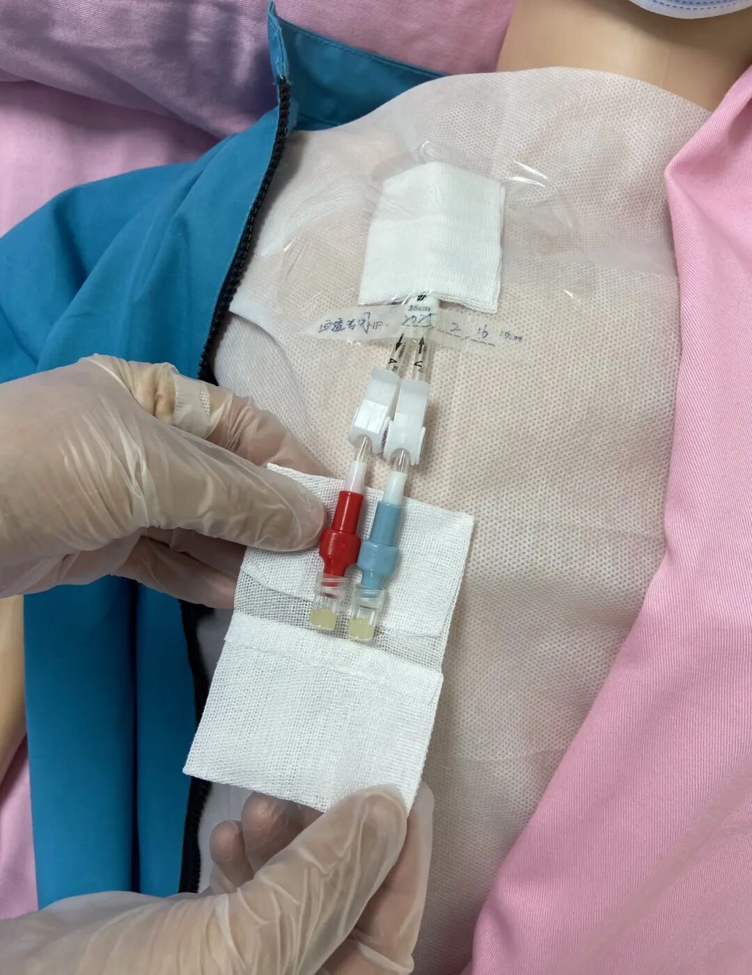 无菌纱块怎么使用一文让你学会透析导管自我换药_https://www.jmylbn.com_新闻资讯_第98张