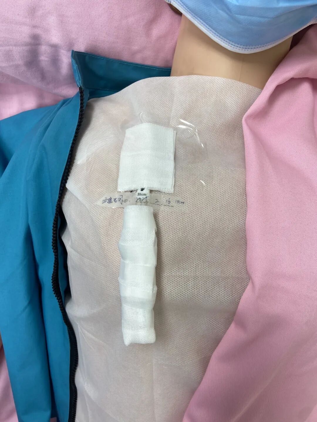 无菌纱块怎么使用一文让你学会透析导管自我换药_https://www.jmylbn.com_新闻资讯_第105张