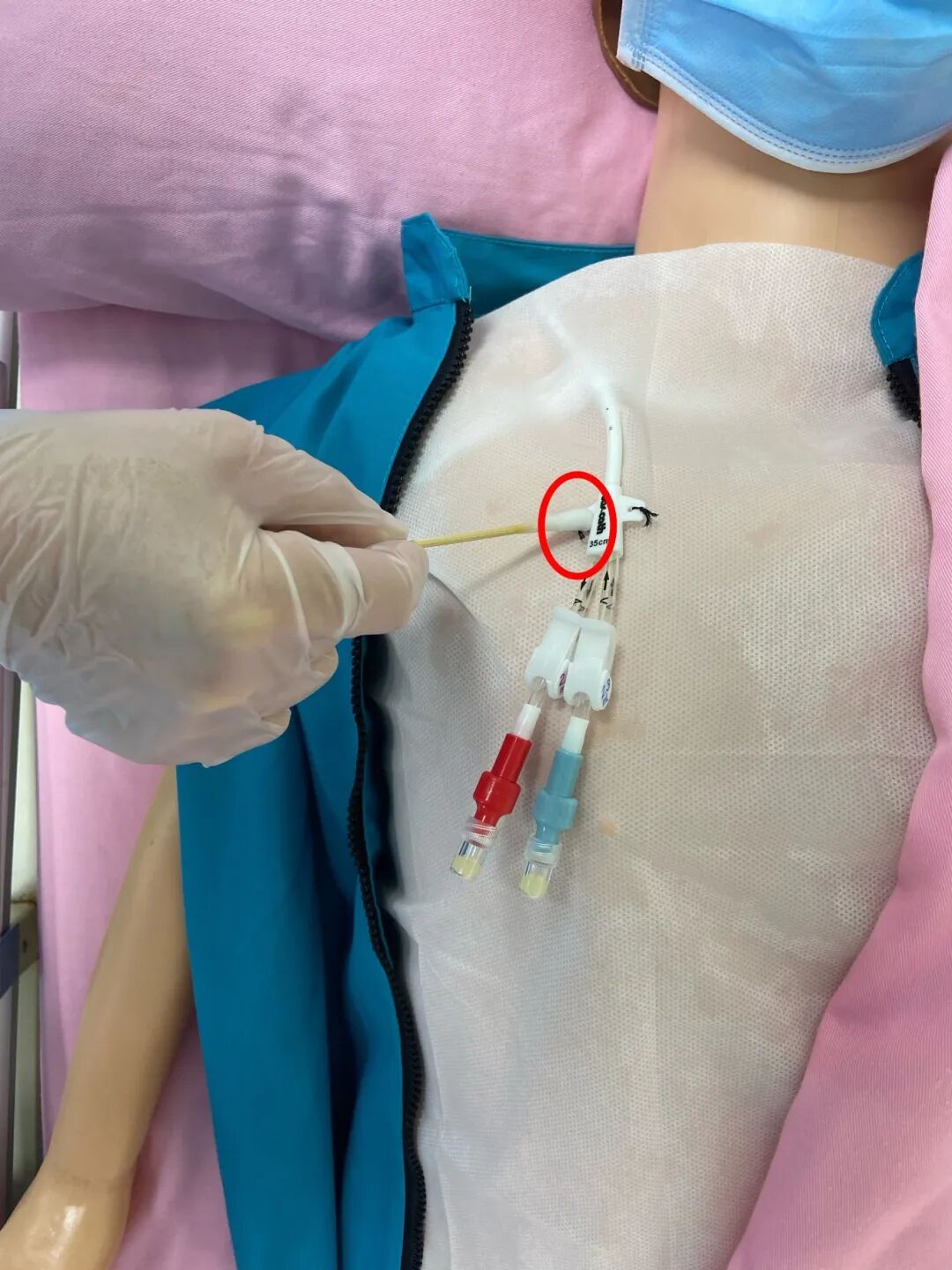 无菌纱块怎么使用一文让你学会透析导管自我换药_https://www.jmylbn.com_新闻资讯_第76张