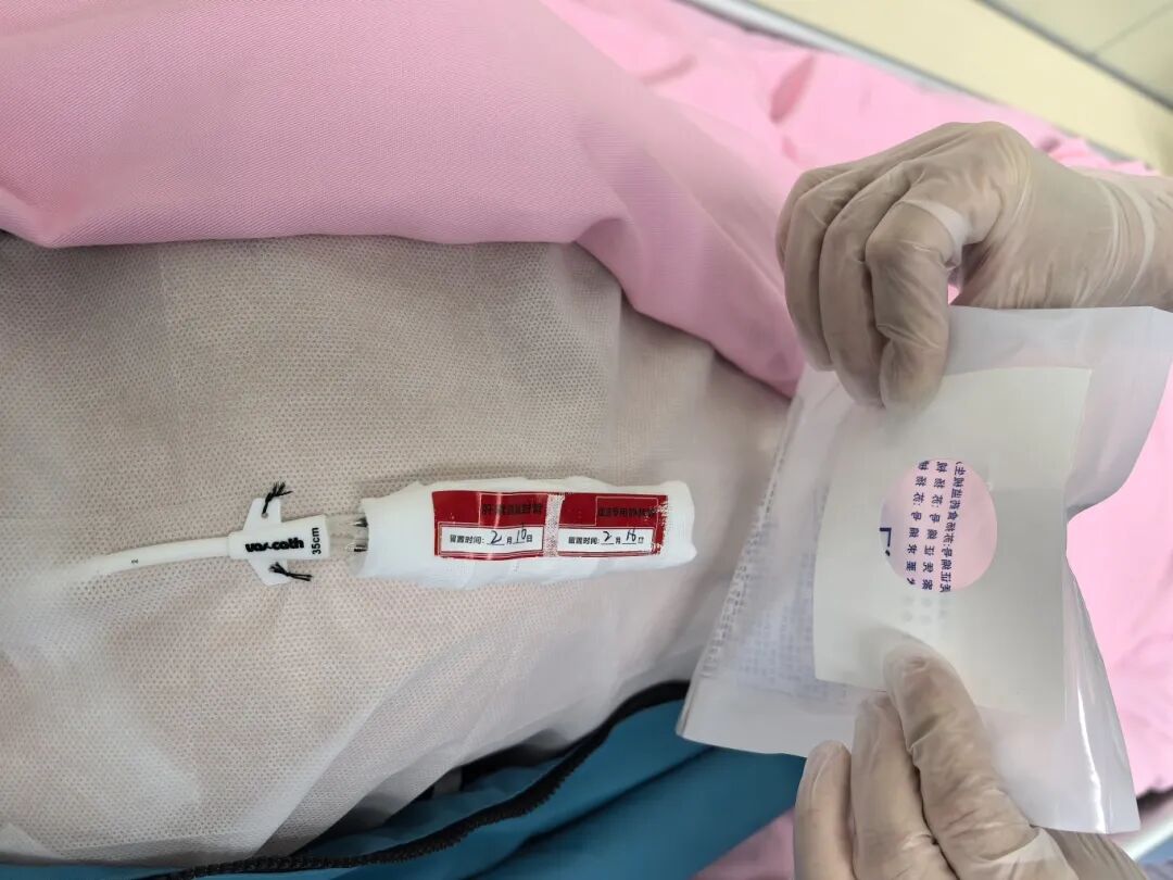无菌纱块怎么使用一文让你学会透析导管自我换药_https://www.jmylbn.com_新闻资讯_第123张