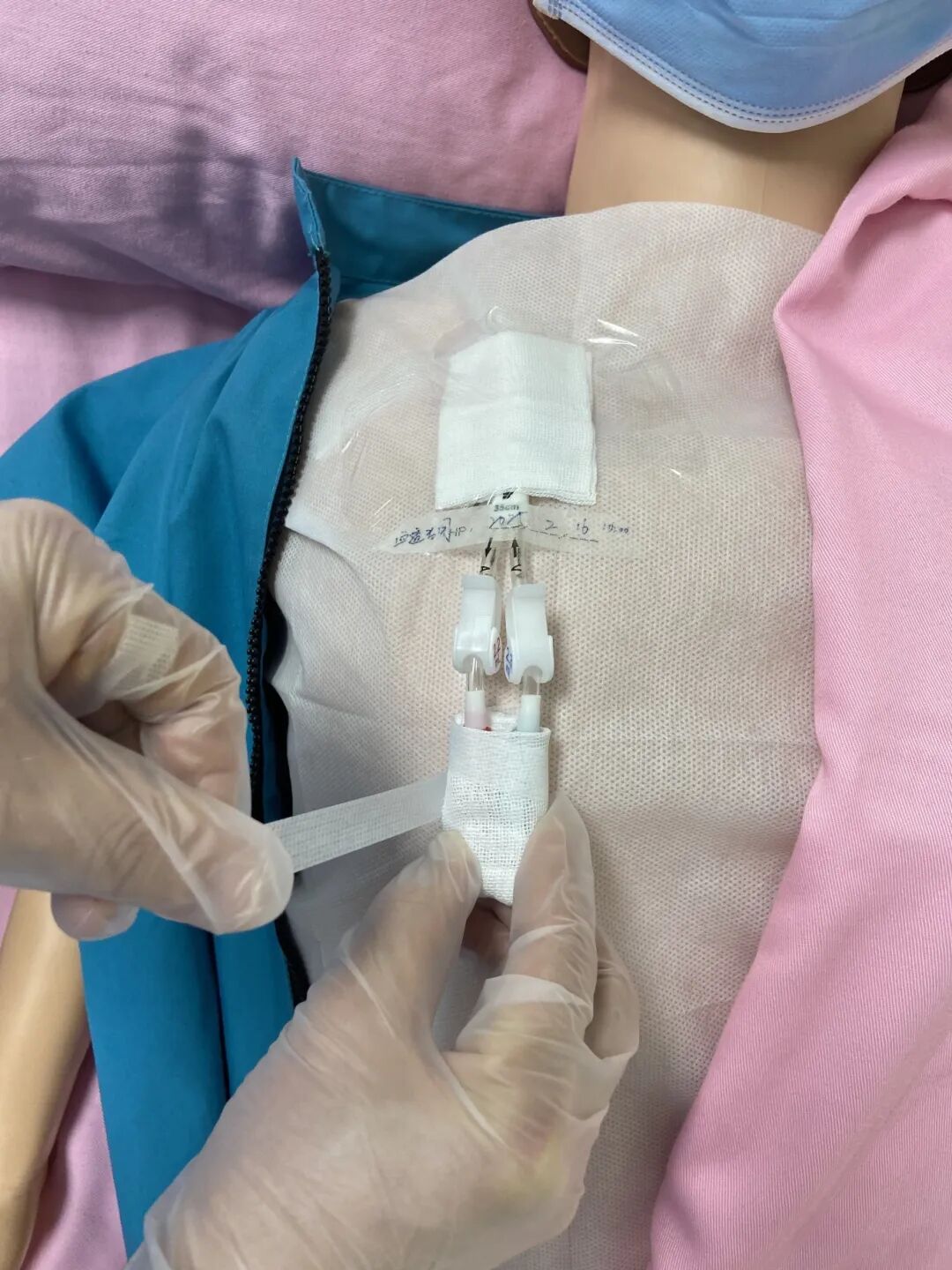 无菌纱块怎么使用一文让你学会透析导管自我换药_https://www.jmylbn.com_新闻资讯_第101张