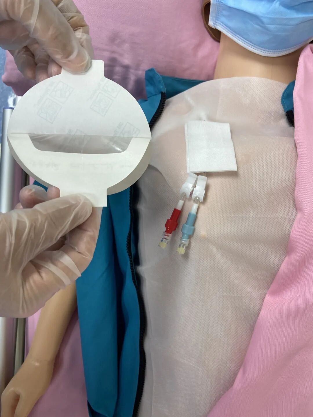 无菌纱块怎么使用一文让你学会透析导管自我换药_https://www.jmylbn.com_新闻资讯_第88张