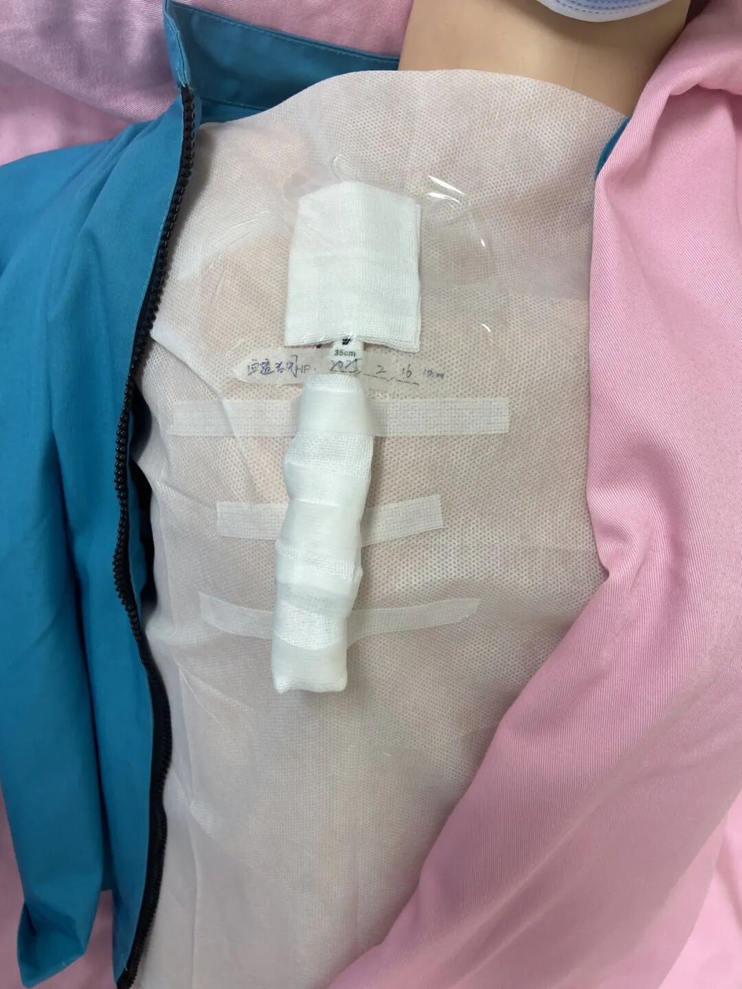 无菌纱块怎么使用一文让你学会透析导管自我换药_https://www.jmylbn.com_新闻资讯_第109张