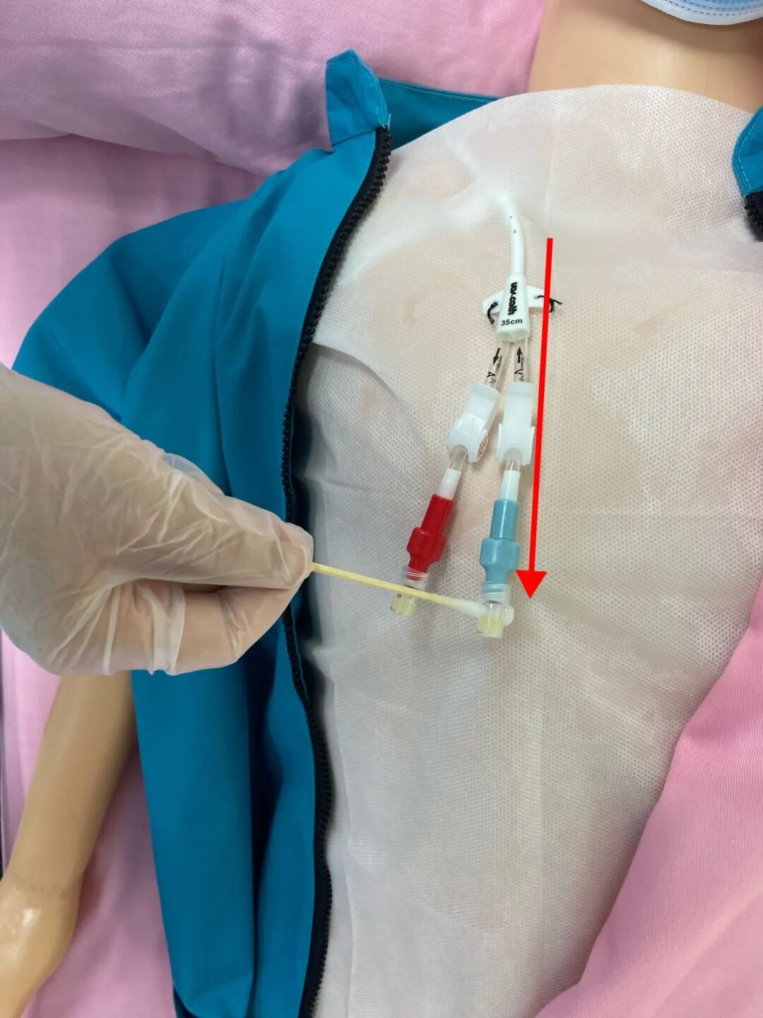 无菌纱块怎么使用一文让你学会透析导管自我换药_https://www.jmylbn.com_新闻资讯_第75张