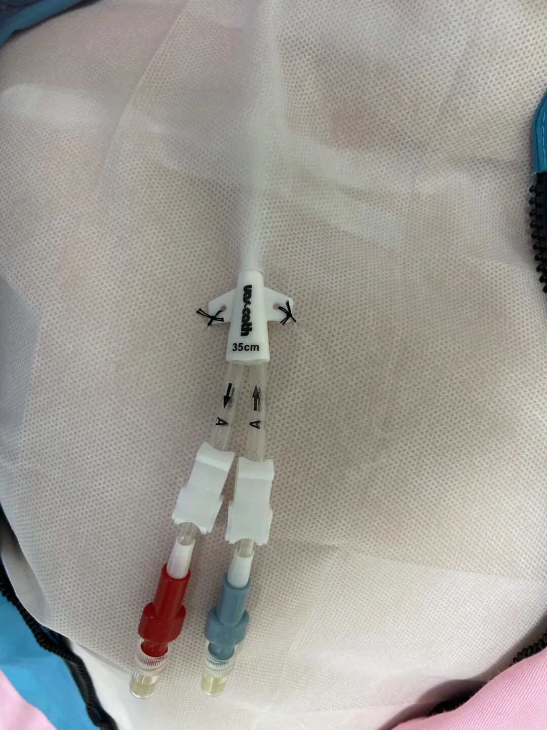 无菌纱块怎么使用一文让你学会透析导管自我换药_https://www.jmylbn.com_新闻资讯_第83张