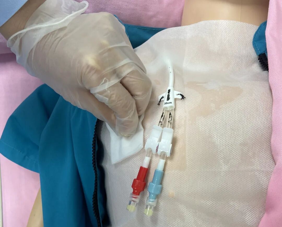 无菌纱块怎么使用一文让你学会透析导管自我换药_https://www.jmylbn.com_新闻资讯_第52张